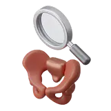 Полная диагностика тазового дна за одно посещение