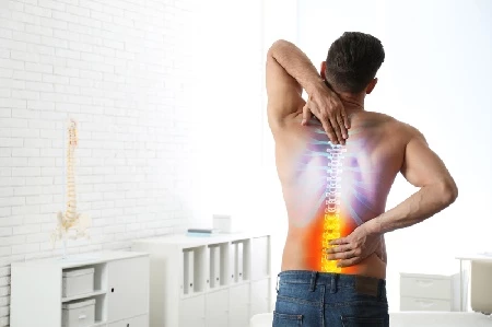 Остеохондроз позвоночника