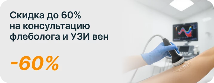 Скидка до 60% на консультацию флеболога и УЗИ вен