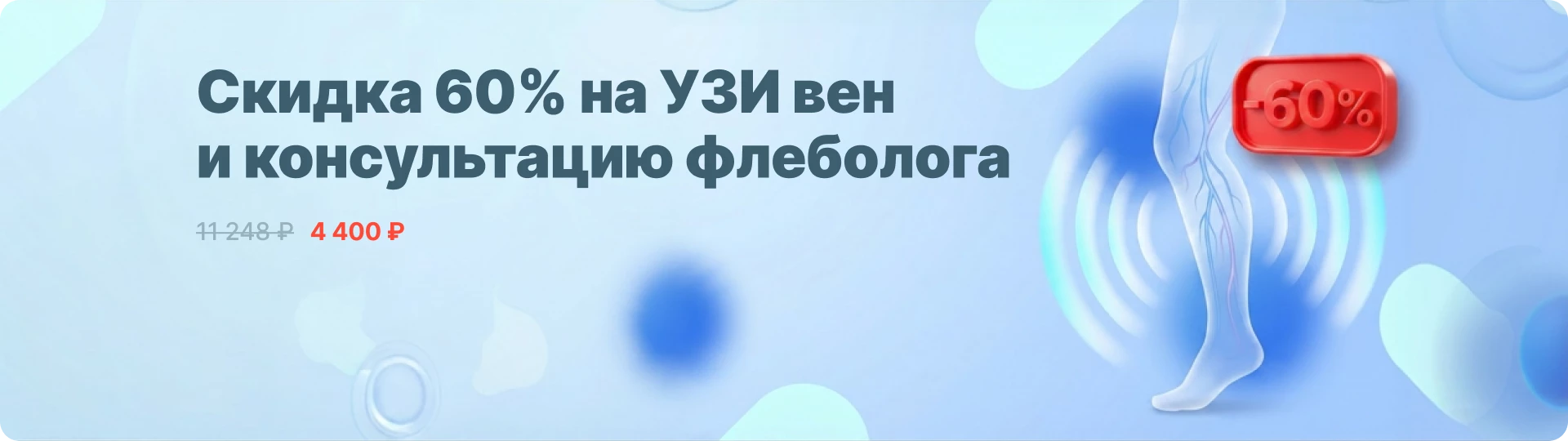 Скидка до 60% на консультацию флеболога и УЗИ вен