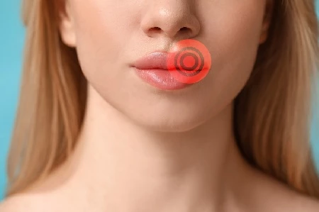 Герпес, Цитомегаловирус, вирус Эпштейн-Барр