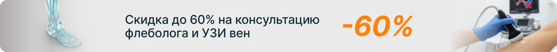 Скидка до 60% на консультацию флеболога и УЗИ вен