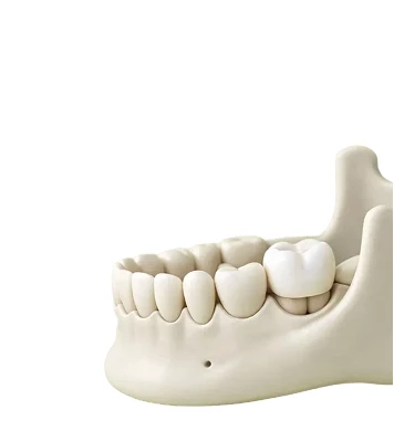 Протезирование зубов