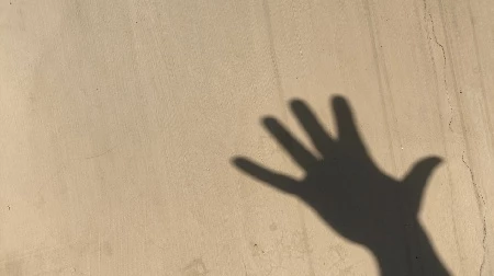 Лечение контрактуры Дюпюитрена