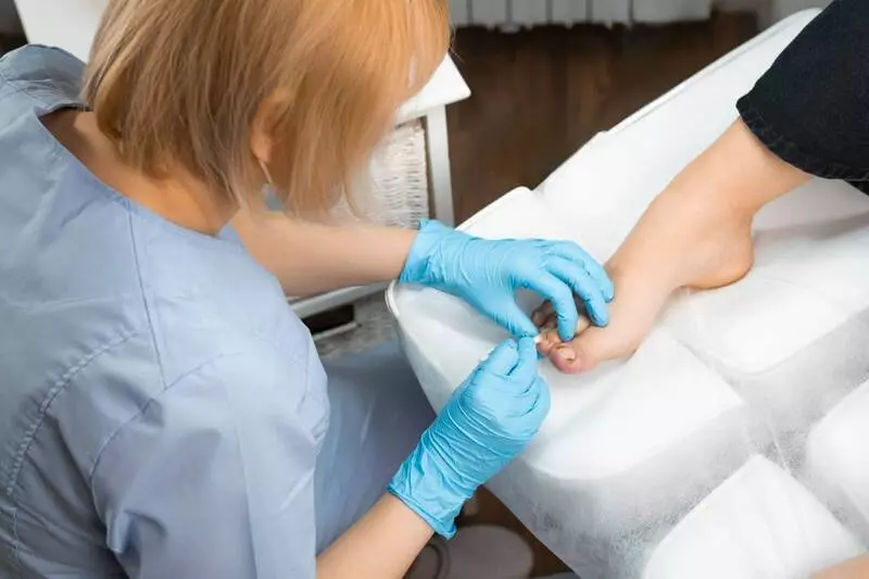 Как лечить вросший ноготь