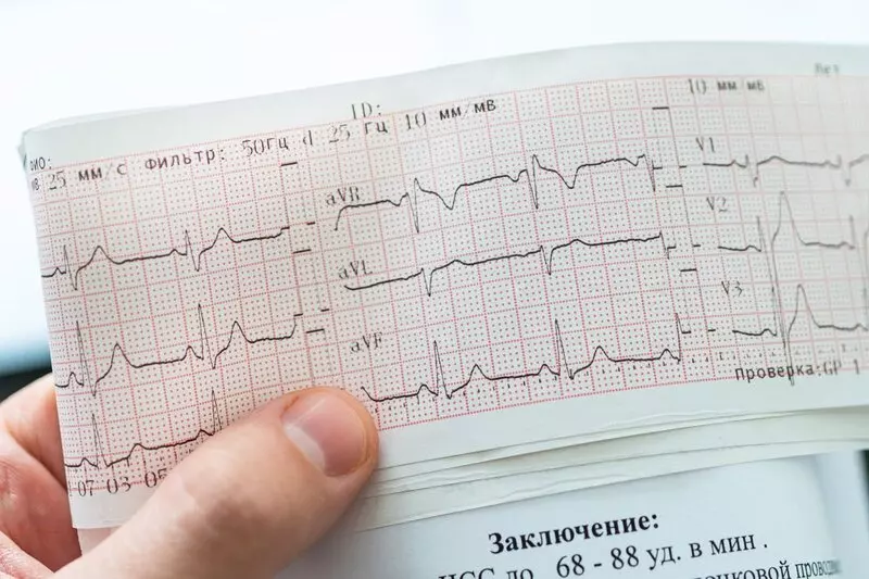 Как лечат аритмию сегодня: персональный подход к каждому пациенту