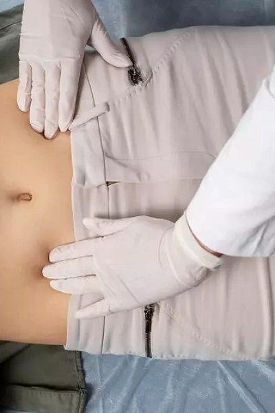 Иссечение свища прямой кишки