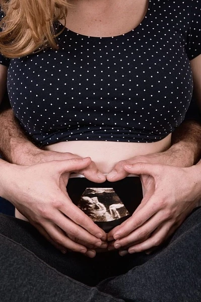 Головное предлежание плода