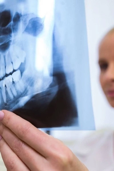 Ортопантомограмма