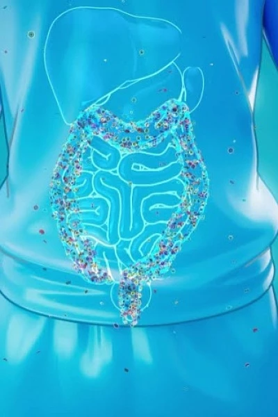 Удаление полипа в кишке лазером