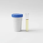 Анализы мочи