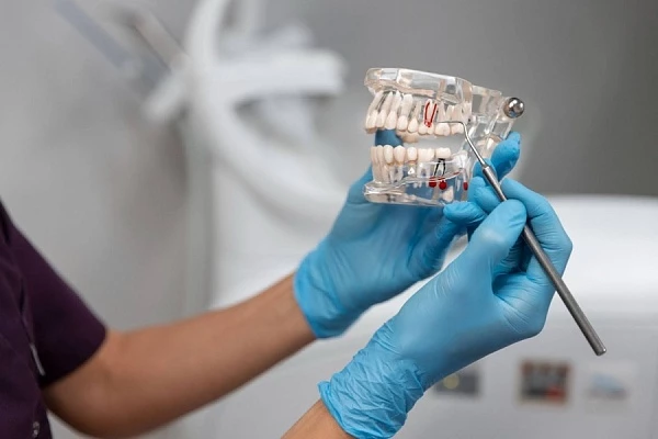 Импланты Nobel