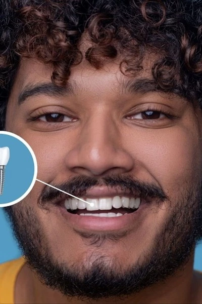 Имплантация одного зуба