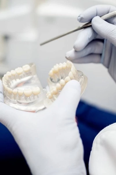 Имплантация всех зубов