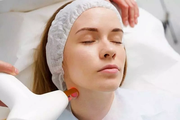 Лазерная шлифовка рубца