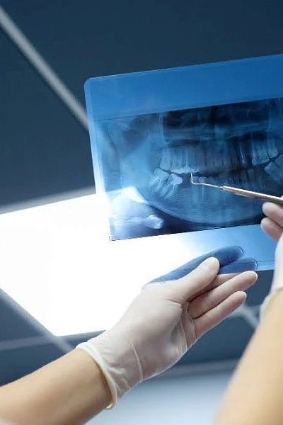 Сканирование зубов 3D