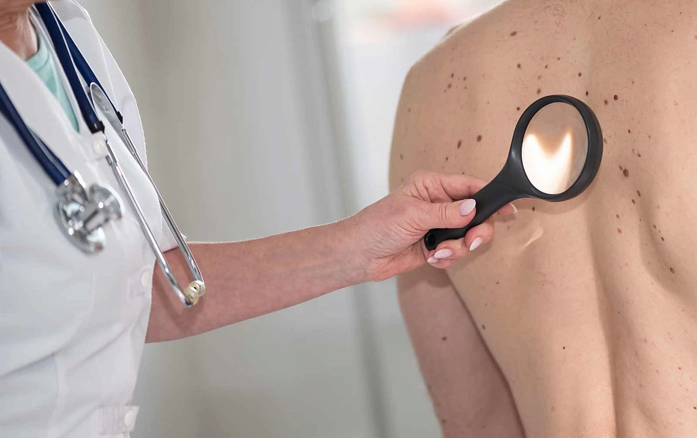 Выявление прогрессирующего диспластического невуса врачом первичного звена – путь к профилактике и ранней диагностике меланомы кожи.