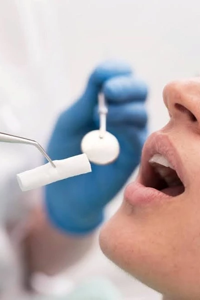 Удаление нерва зуба