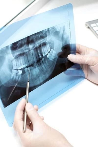 Рентген зубов