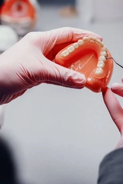 Протез верхней челюсти