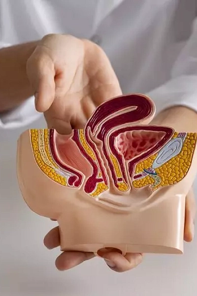 Геморроидэктомия (удаление геморроя)