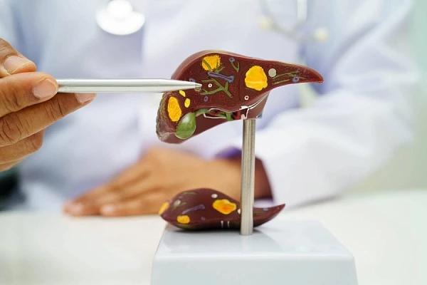 Токсический гепатит