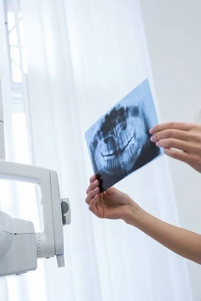 Компьютерная аксиография