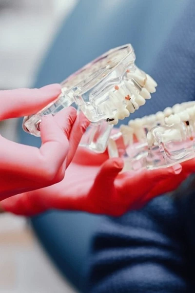 Несъемное протезирование