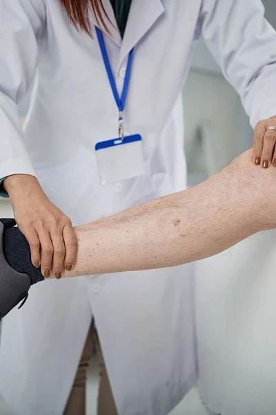 Склеротерапия