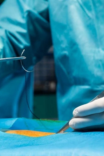 Удаление металлоконструкций после перелома