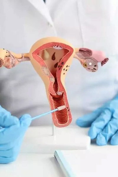 Биопсия шейки матки