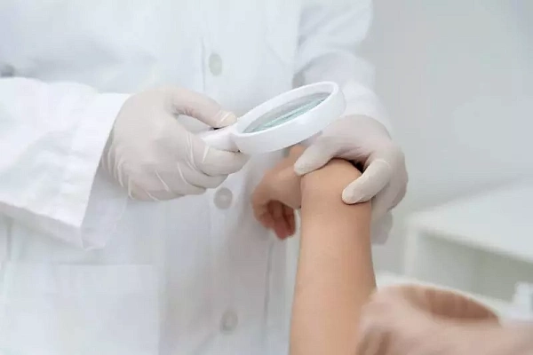 Удаление липомы