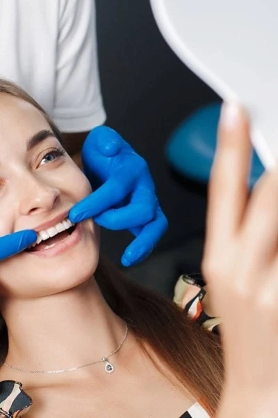 Керамические виниры