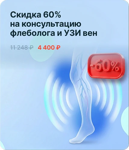 Скидка до 60% на консультацию флеболога и УЗИ вен