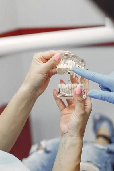 Импланты SuperLine